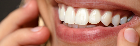 Smile Makeovers