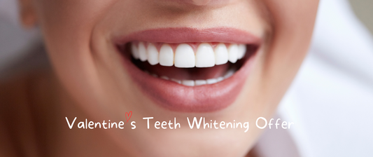 Professional Teeth Whitening