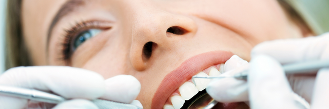 Preventative Dentistry