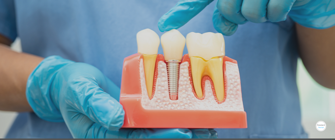 Oral Surgery Services at Roseland Dental